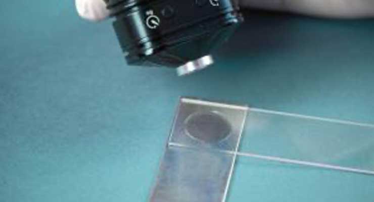 Biocompatible UV Curable Adhesive Formulated for TPU Bonding
